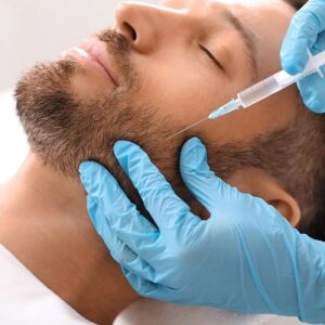 Blog 9 PRP treatment for beard regrowth