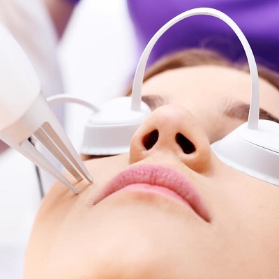 Picosure Laser for Acne Scars