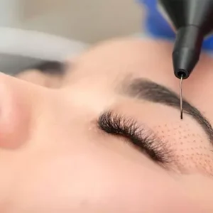 Blog 7 Plexr Plasma Eye Lift Cost in Abu Dhabi!