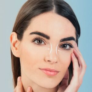 Blog 5 Nose Job Surgery