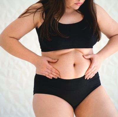 Tummy Tuck in Al Ain