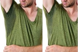 Before and After Hyperhidrosis Treatment in Abu Dhabi