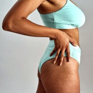 Cellulite Removal Treatment Cost in Abu Dhabi