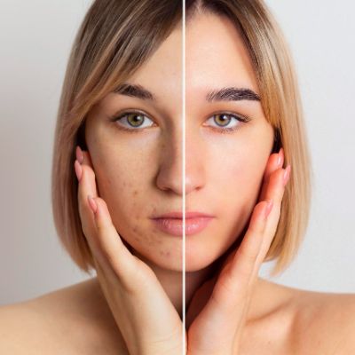 Dermal Pigmentation Cost in Abu Dhabi