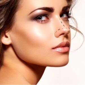 Blog 3 Liquid Rhinoplasty Cost in Abu Dhabi