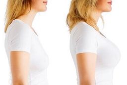 Before and After Breast Lift Surgery in Abu Dhabi