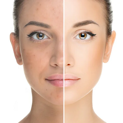 Face Rejuvenation Cost in Abu Dhabi 2 Face Rejuvenation cost in Abu Dhabi