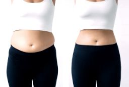 Lipotropic Injections in Abu Dhabi Before After