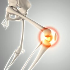 Orthopedic Surgery Cost in Abu Dhabi