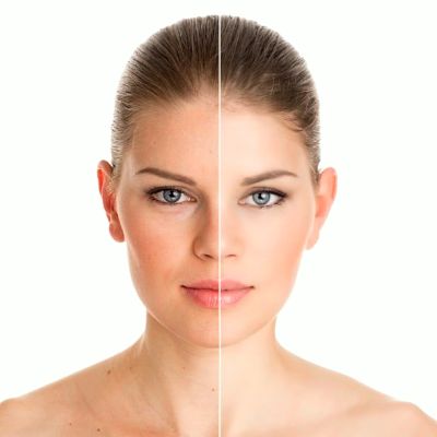 Skin Rejuvenation Treatments Cost in Abu Dhabi 9 Skin Rejuvenation Treatments Cost in Abu Dhabi