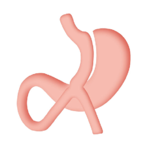 Mini Gastric Bypass Cost In Abu Dhabi