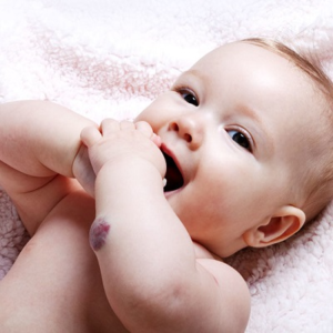 Blog 1 Hemangioma Treatment Cost In Abu Dhabi