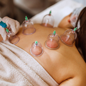 Blog 7 Hijama Treatment Cost in Abu Dhabi