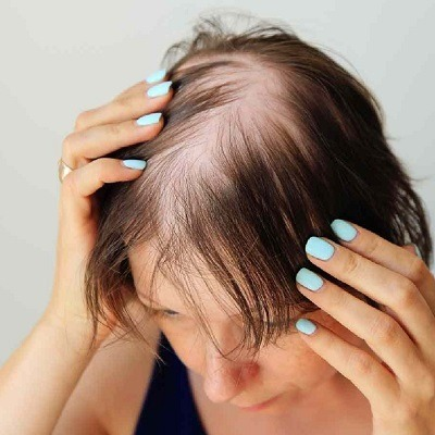 Hair Loss & Nail Disorders Cost in Abu Dhabi 2 Hair Loss Nail Disorders Cost in Abu Dhabi