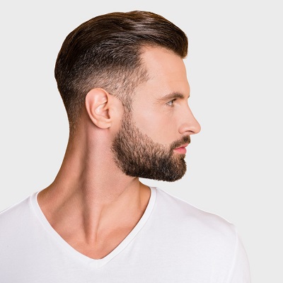 Sideburn Hair Transplant Cost in Abu Dhabi 2 Sideburn Hair Transplant Cost in Abu Dhabi
