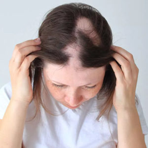 Blog 7 How To Regrow Hair On Bald Spot