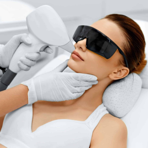 Blog 5 Is Laser Hair Removal Safe On The Face?