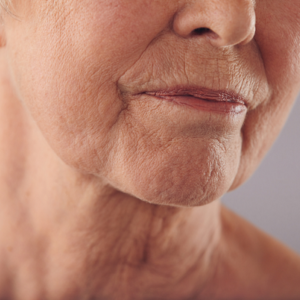 Blog 7 How To Firm Sagging Skin Without Surgery