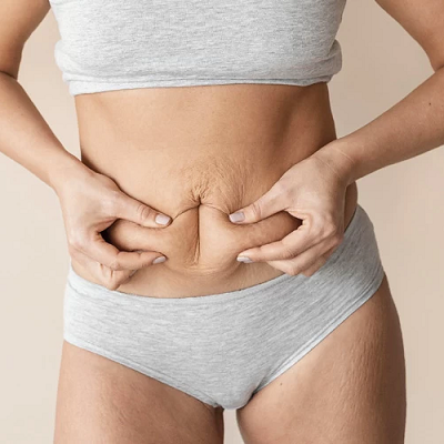 Best Mini Abdominoplasty in Abu Dhabi