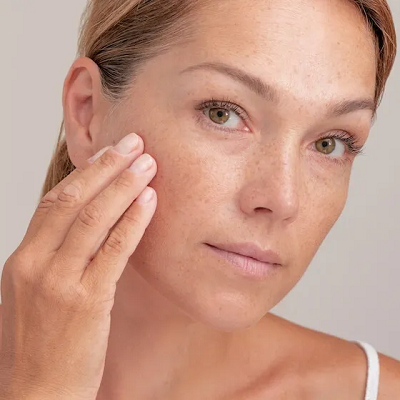 Is Dermal Pigmentation Curable with Skincare Treatments