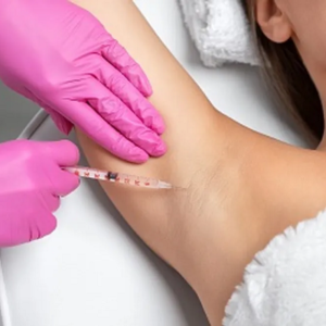 Does Botox Reduce Sweating