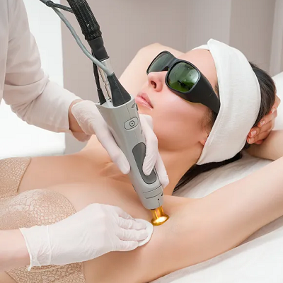 Does Laser Hair Removal Help With Ingrown Hair