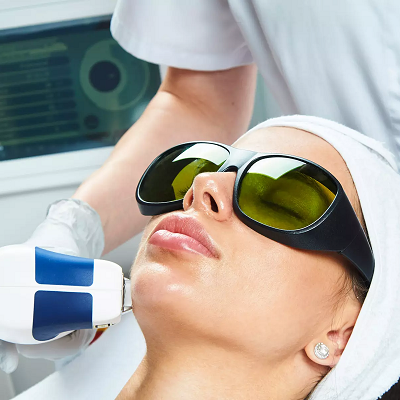 Does Laser Hair Removal Work for PCOS?