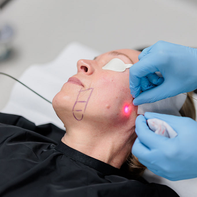 EndoLift in Abu Dhabi