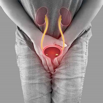 Male Urine Disorders Treatment in Abu Dhabi