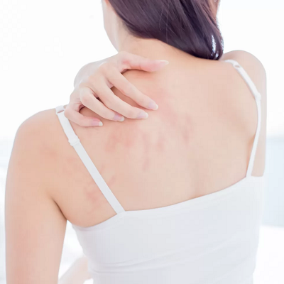 Skin Diseases 2 Skin Diseases Treatment in Abu Dhabi