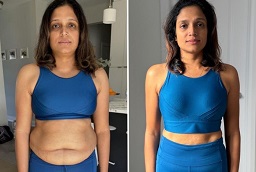 Before And After Wegovy Injections