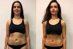 Wegovy Injections After And Before