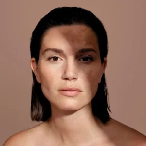 Enfield Royal Clinic Abu Dhabi 22 How To Get Rid Of Dark Spots On The Body?